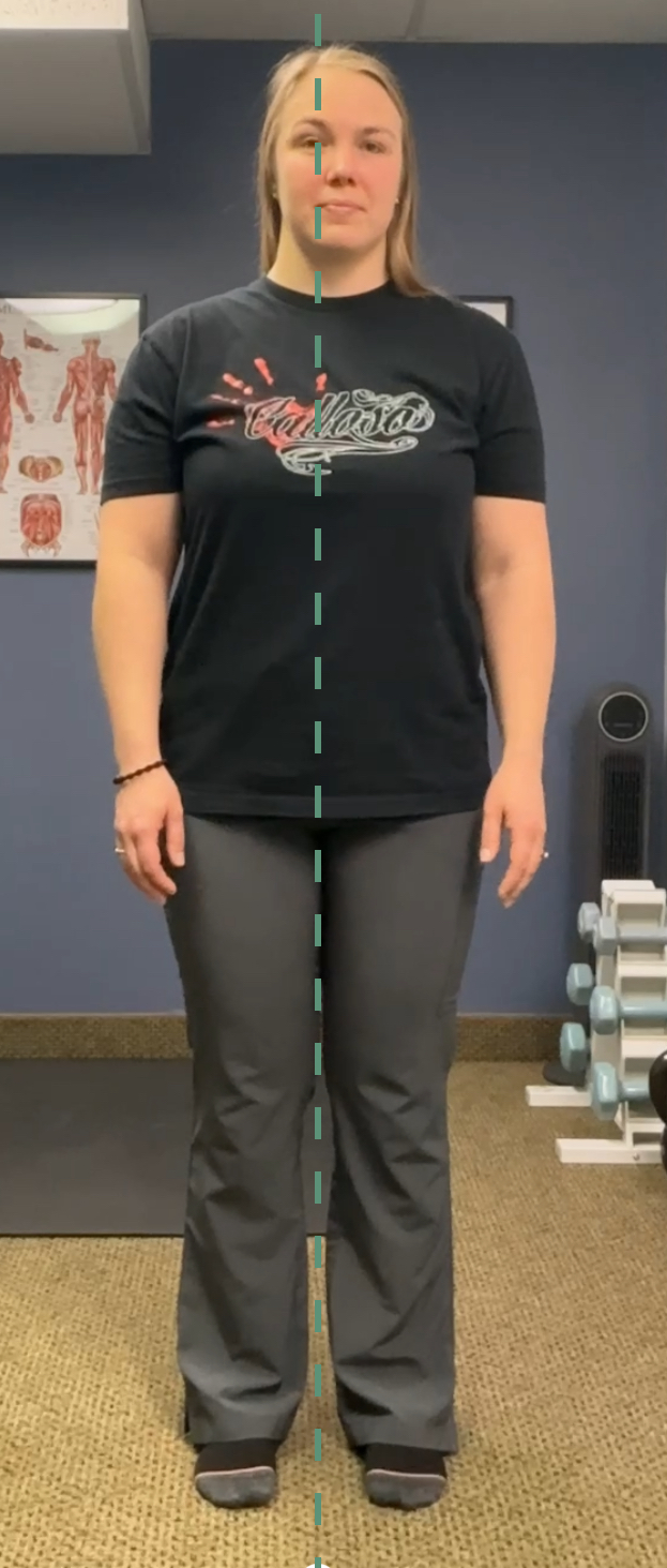 Front-view posture measurement during a SYMYO assessment